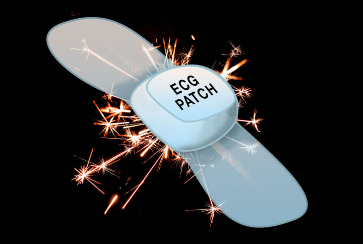 ECG Patch Technology, A Flash in the Pan?